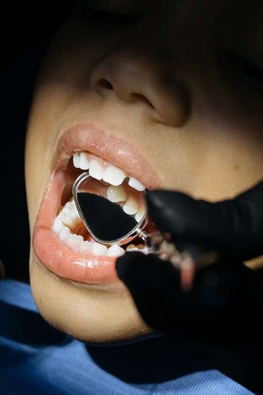 Should I Pull Out My Child's Loose Tooth? | Children's Dentistry of San ...